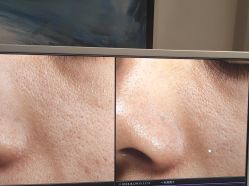 -苑苑vbeauty科技美容SPA