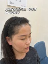 -雍禾植发全国连锁