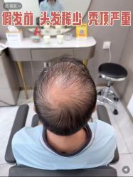 -唐风采假发补发定制