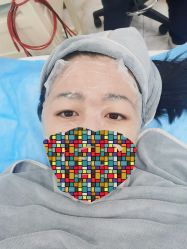 体验前-北京英煌医疗美容