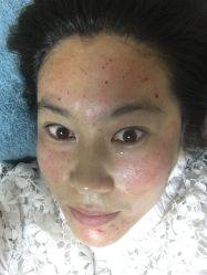 -YooMee优美智能科技美肤机构