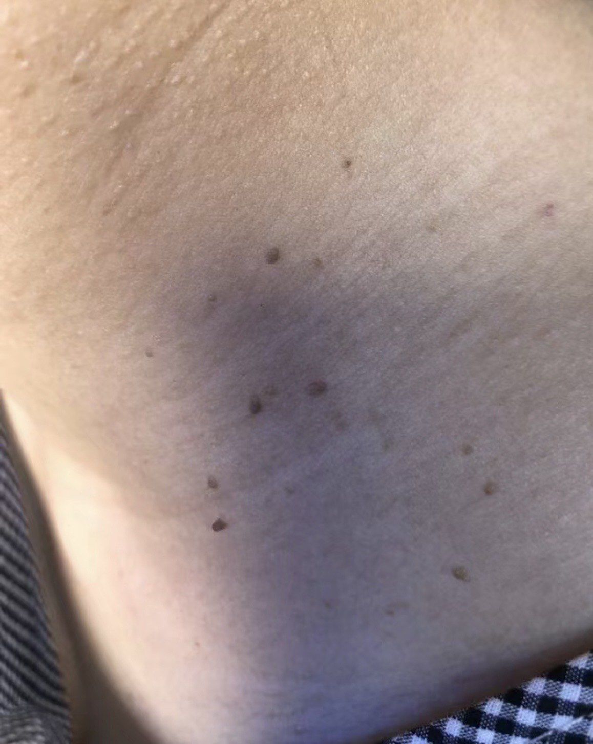 大家猜一下脖子上长的是什么