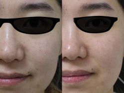 -联合丽格·张菡丽格医疗美容