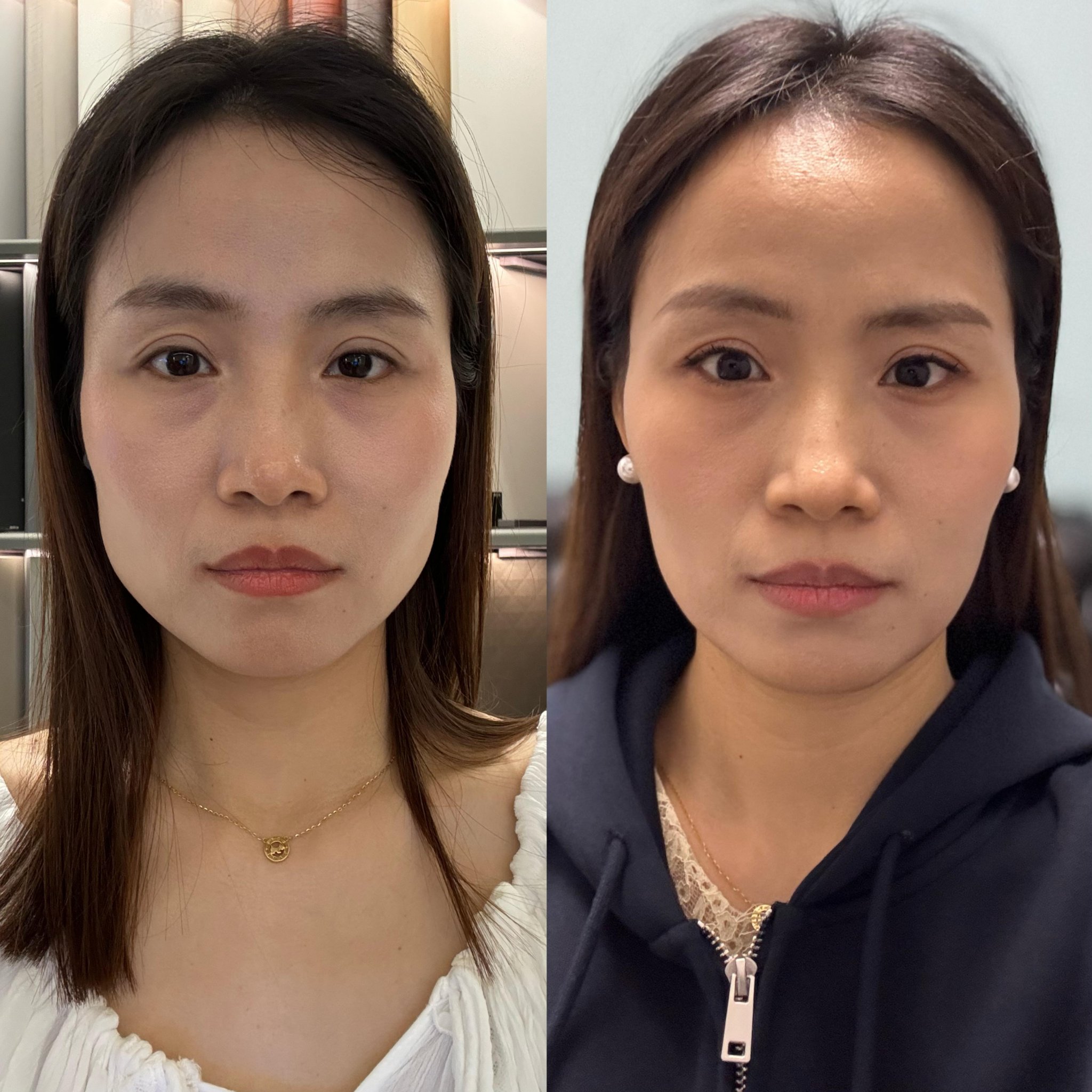 圆脸抖音瘦脸=抖音最近的圆脸女神