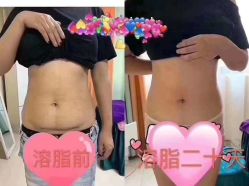 -Lily纤美·科技减脂中心