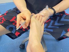 -祖传修脚甲沟炎灰指甲鸡眼
