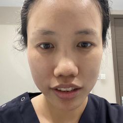 体验后-上海漾颜医疗美容