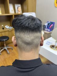 体验前-大麦微针植发全国连锁