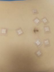 体验后-西安现代妇产医院医疗美容