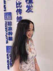 -大麦微针植发全国连锁