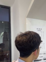 -天使之手