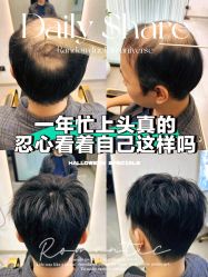 -乐绅男士高端假发定制