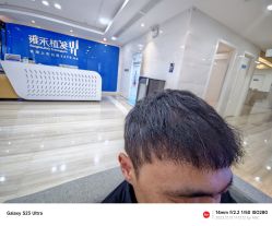 体验后-雍禾植发全国连锁