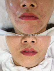 -美愈美肤MEIYU SKIN