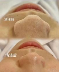 -美愈美肤MEIYU SKIN