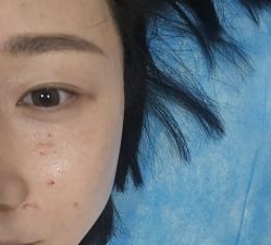 -素美医疗美容·西南眼鼻整形·修复基地