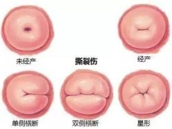 -邢台妇产医院