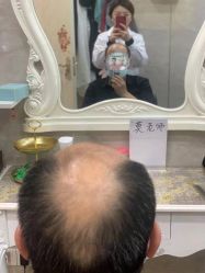 -唐风采假发补发定制