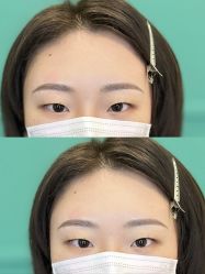 点击看大图 -杨益美学·野生眉半永久纹眉发际线