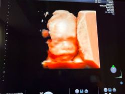 -重庆安琪儿妇产医院-妇幼保健联盟医院