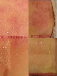 -升艾堂亚健康调理中心