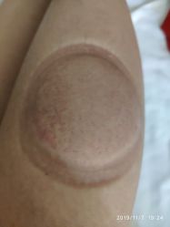 -绿竹·竹罐瘦身养生馆
