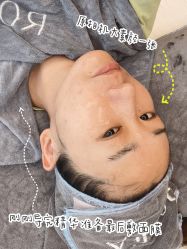 -ROYEA茹彦祛痘·问题肌肤修护中心