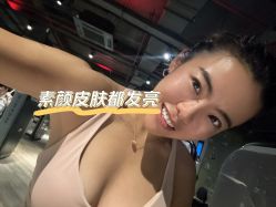 体验后-丰联丽格医疗美容·联合丽格眼整形中心