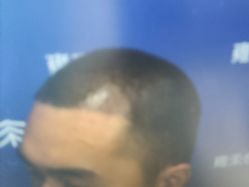 -雍禾植发全国连锁