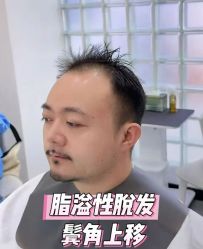 -唐风采假发补发定制