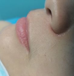 -广州粤秀医疗美容医院