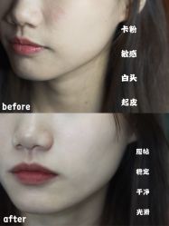 -美壹生诊所皮肤管理中心·海菲秀&Legacy美白舱