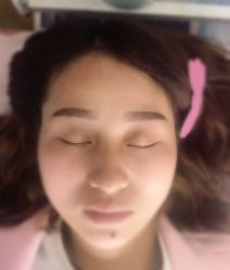 点击看大图 -郡艺医疗美容·微整·眼鼻吸脂