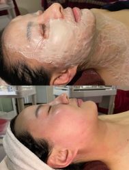 -苗方清颜痘肌研究所