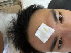 -成都苗方清颜专业祛痘