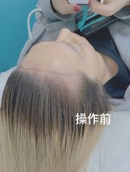 点击看大图 -MISS STAR·半永久纹眉·发际线·美瞳线