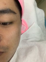 -痘博士广州·全国连锁祛痘机构