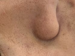 点击看大图 -蕾特恩专业祛痘·皮肤管理