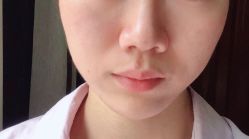 -常熟时代医疗美容