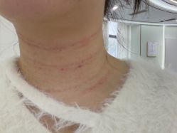 -杭州奥拉克医疗美容门诊部