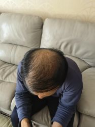 -唐风采假发补发定制