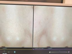 -苑苑vbeauty科技美容SPA