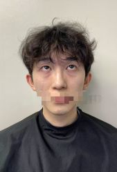 -天津健丽·去眼袋医疗美容机构