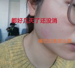 -八大处整形