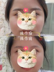 -西施无菌半永久纹绣眉眼影唇轻增发纹发际线