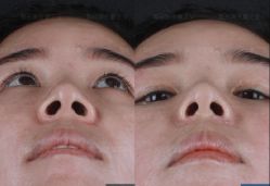 -北京米扬丽格医疗美容·联合丽格鼻整形中心