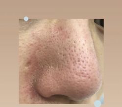 -Cream88颜皮肤管理中心