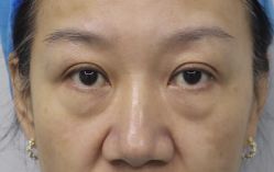 -天津健丽·去眼袋医疗美容机构