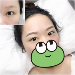 点击看大图 -MIVI·纹眉半永久野生眉