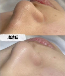 -LUNA皮相美·骨相美高级美感